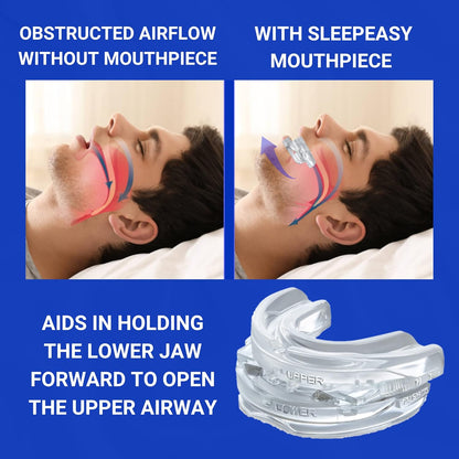 Anti-Snoring & Bruxism Adjustable Mouth Guard