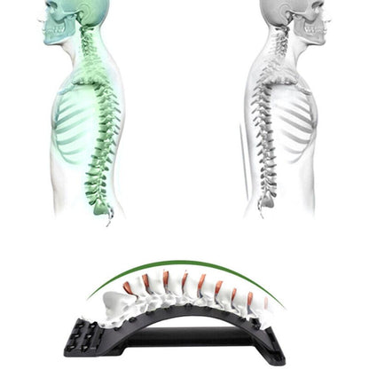 Orthopaedic Back Stretcher