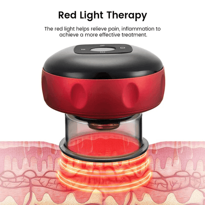 Electric Vacuum Cupping Massager